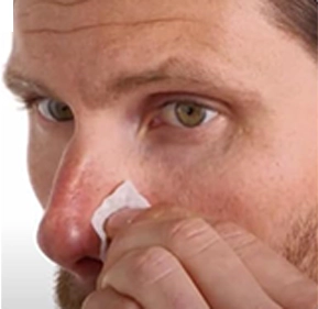 Magnetic Nasal Dilator