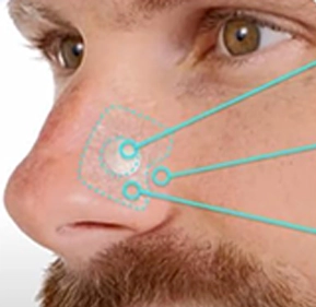 Magnetic Nasal Dilator
