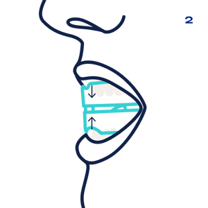 Snoreka