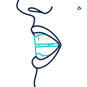 Snoreka