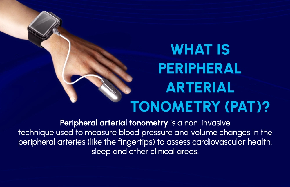 Peripheral Arterial Tonometry (PAT) vs. Photoplethysmography (PPG)